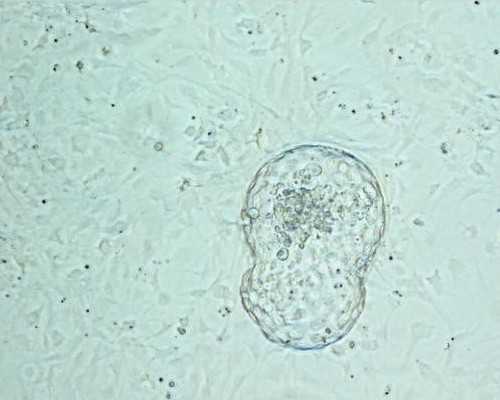 2026淄博比较出名的三代试管医院排名前十名，前五名机构不用等