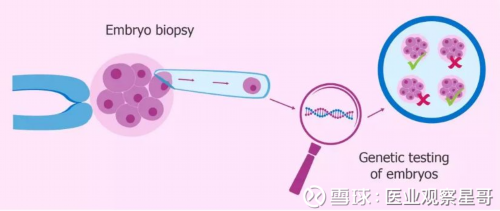 代孕公司官网网站,
              卵泡未成熟14mm取出来能培养成功吗？
           