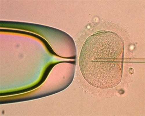 有哪些正规代孕公司_专业的代孕网站,宝宝拉肚子脱水症状表现