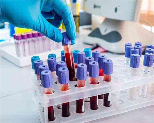 做试管代孕要多钱,安康市卫生计生局：普及优生优育五项检查相关知识