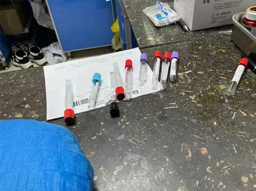 人工助孕机构-无创dna报告单